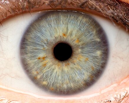 Деменцию можно определить по глазам