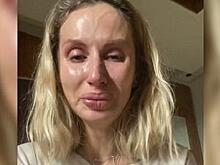 Светлану Лободу раскритиковали подписчики за безвкусное платье