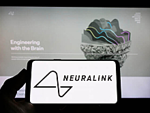 Маск рассказал о вживлении чипа Neuralink ещё одному пациенту