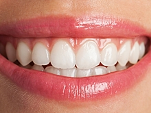 Стоматолог предупредил о процедуре, которая может повредить ваши зубы