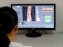 Что делать для профилактики остеопороза