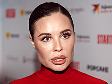 Юлия Михалкова впервые раскрыла свое заболевание