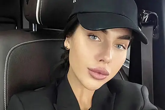 Бывший парень впавшей в кому российской модели критиковал ее внешность