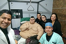 Самый толстый человек в мире похудел и остался с 95 килограммами лишней кожи