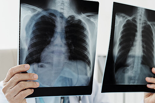 Более 20 рентген-аппаратов закупят в больницы Московской области