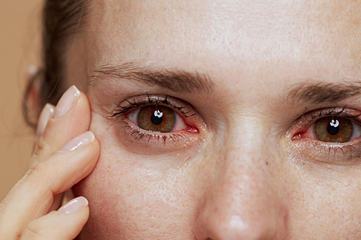 Врач Крестьянинова объяснила, почему недостаток сна приводит к ухудшению зрения