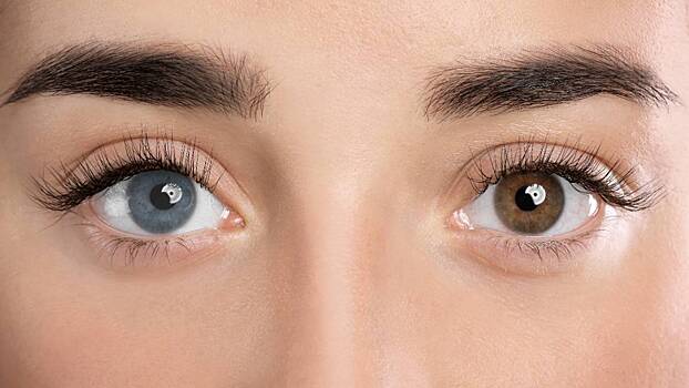 Изменение цвета глаз: что такое кератопигментация и насколько это опасно