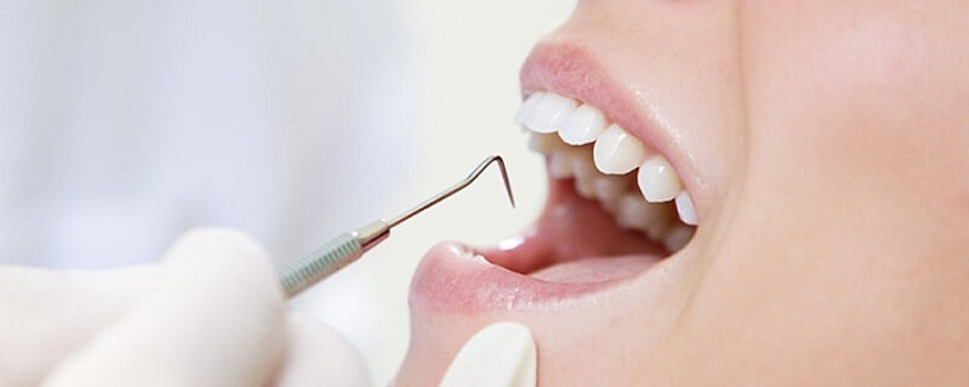 Ученые создали долговечные зубные пломбы