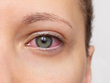 Эксперт Борозденко: Подергивание век может указывать на нехватку магния