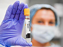 Число случаев COVID-19 в России за сутки увеличилось на 28 585