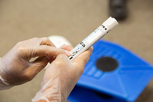 Венеролог назвала болезни, при которых стоит провериться на ВИЧ