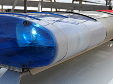 15-летняя калужанка попала в больницу после ДТП