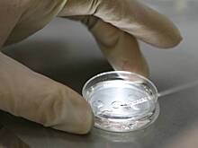 Ученые сообщили об обнаружении вызывающего волчанку вируса