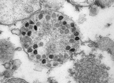 Новый штамм коронавируса «омикрон» в Оренбуржье обнаружили у 25 человек