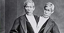 История первых сиамских братьев-близнецов