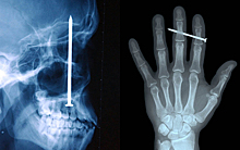 12 шокирующих рентген‑фотографий