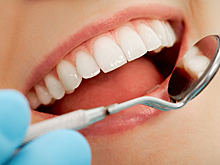 Стоматолог перечислил продукты, которые разрушают зубы
