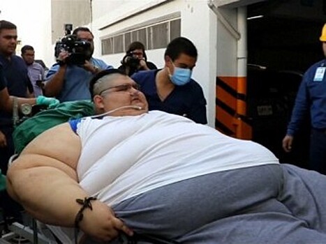 Самому толстому мужчине в мире отрезали часть желудка