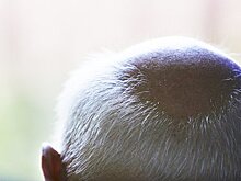 Малышева назвала приводящий к облысению популярный продукт