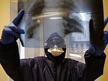 Российский онколог назвал главный симптом рака легкого