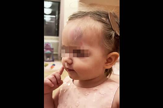 Пятилетняя дочь рэпера ST ударилась головой при падении