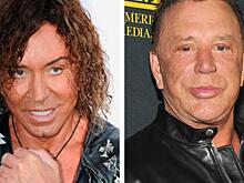 Звездные “близнецы”: знаменитости, похожие друг на друга после пластики