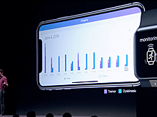 Apple Watch займутся диагностикой болезни Паркинсона