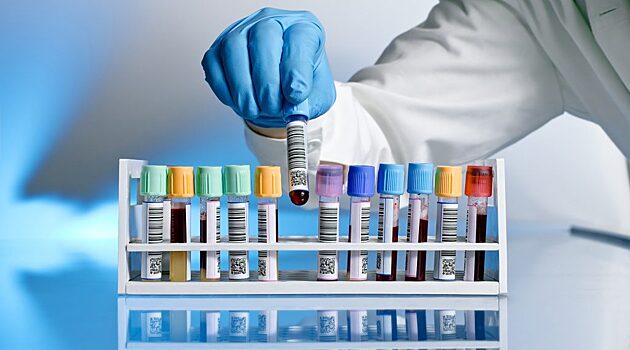 Компании “Медси” и “Инвитро” не испытывают больших проблем с реагентами