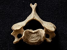 Врачи в Кургане выполнили операцию, установив новый рекорд