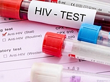 20 тысяч жителей Алтайского края являются носителями ВИЧ-инфекции