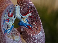 Врач перечислил популярные мифы о раке легкого