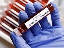 В ВОЗ признались в неведении по поводу ситуации с COVID-19