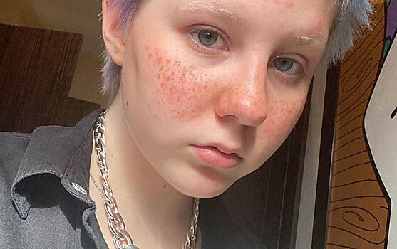 Синий «ежик», белые брови и веснушки: 12-летняя дочь Глюк’oZы удивляет дерзкими экспериментами с внешностью