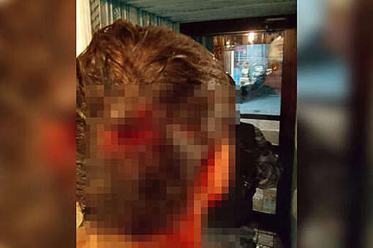 В Перми конфликт между посетителями кафе закончился стрельбой и травмами