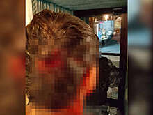 В Перми конфликт между посетителями кафе закончился стрельбой и травмами