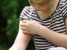 Белгородские пляжи обработают от клещей и комаров