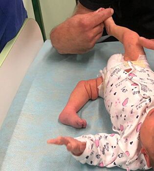 Петербургские врачи за два часа вылечили вывих сустава у младенца из Ростова