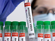 В России оценили необходимость в дополнительных мерах против эпидемии оспы обезьян