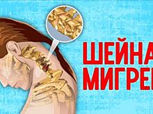 Шейная мигрень: не пытайтесь излечить препаратами! Если постоянная боль в затылочной части головы…