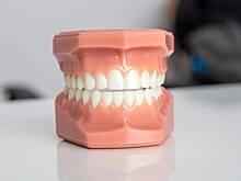 Стоматолог рассказал, стоит ли взрослому исправлять прикус