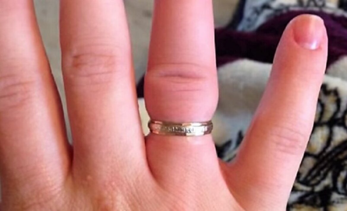 Лопнуло золотое кольцо. Обручальное кольцо на пальце.