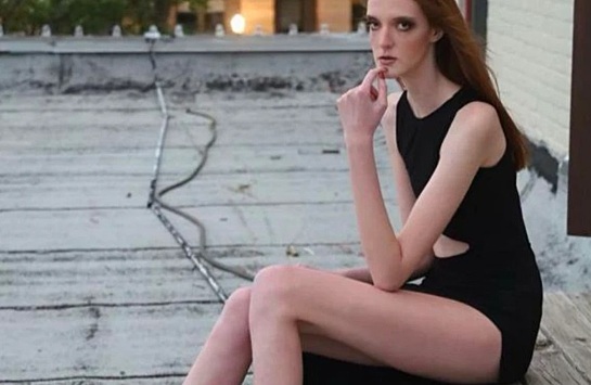 Как выглядит 19-летняя обладательница самых длинных ног