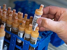 Вирусолог объяснила ошибки тестов на коронавирус