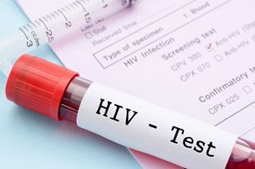 Псковичи могут сдать бесплатный тест на ВИЧ