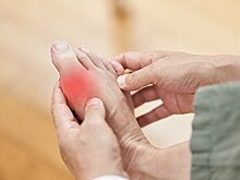 Выявлен новый молекулярный механизм возникновения подагры