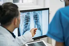 Рак лёгких связан с курением: мнение пульмонолога