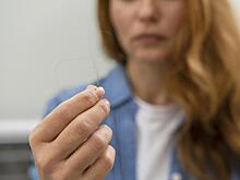 Хотела остановить выпадение волос: россиянка получила заражение крови и лысины после мезотерапии