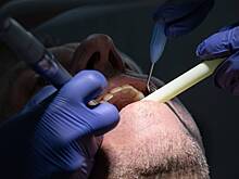 Зубная боль у молодого мужчины оказалась симптомом рака