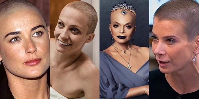 Завораживающе лысые: российские звезды, которые решились на кардинальную смену имиджа