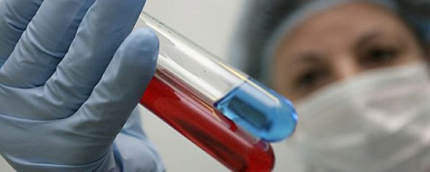 Сотрудники компании «ТЭМПО» отравились в столовой